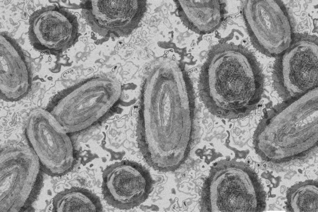На Аляске умер первый человек от вируса Alaskapox